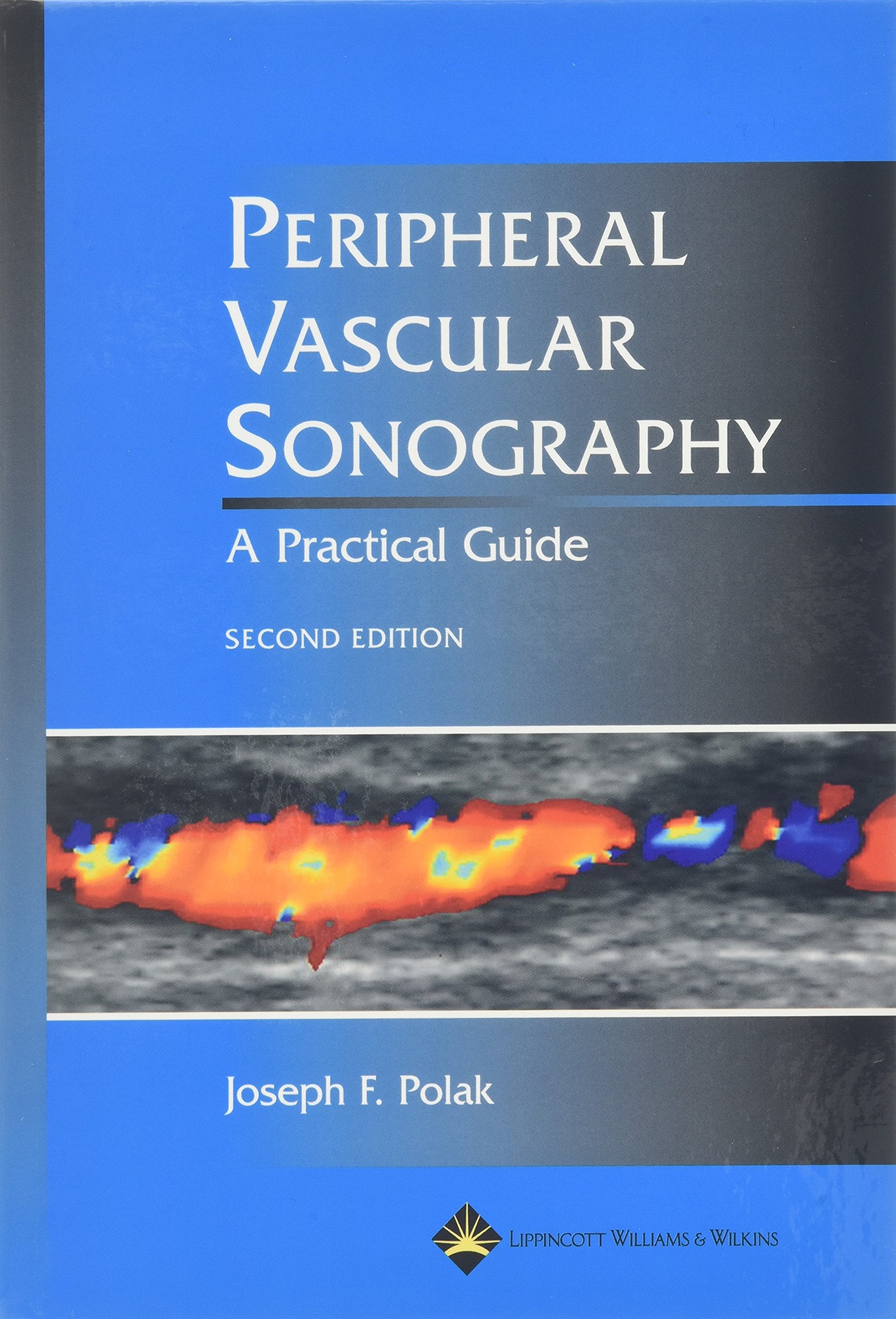Peripheral Vascular Sonography: A Practical Guide,Used