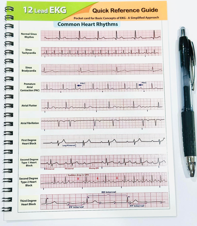 12 Lead EKG Pocket Card,Used