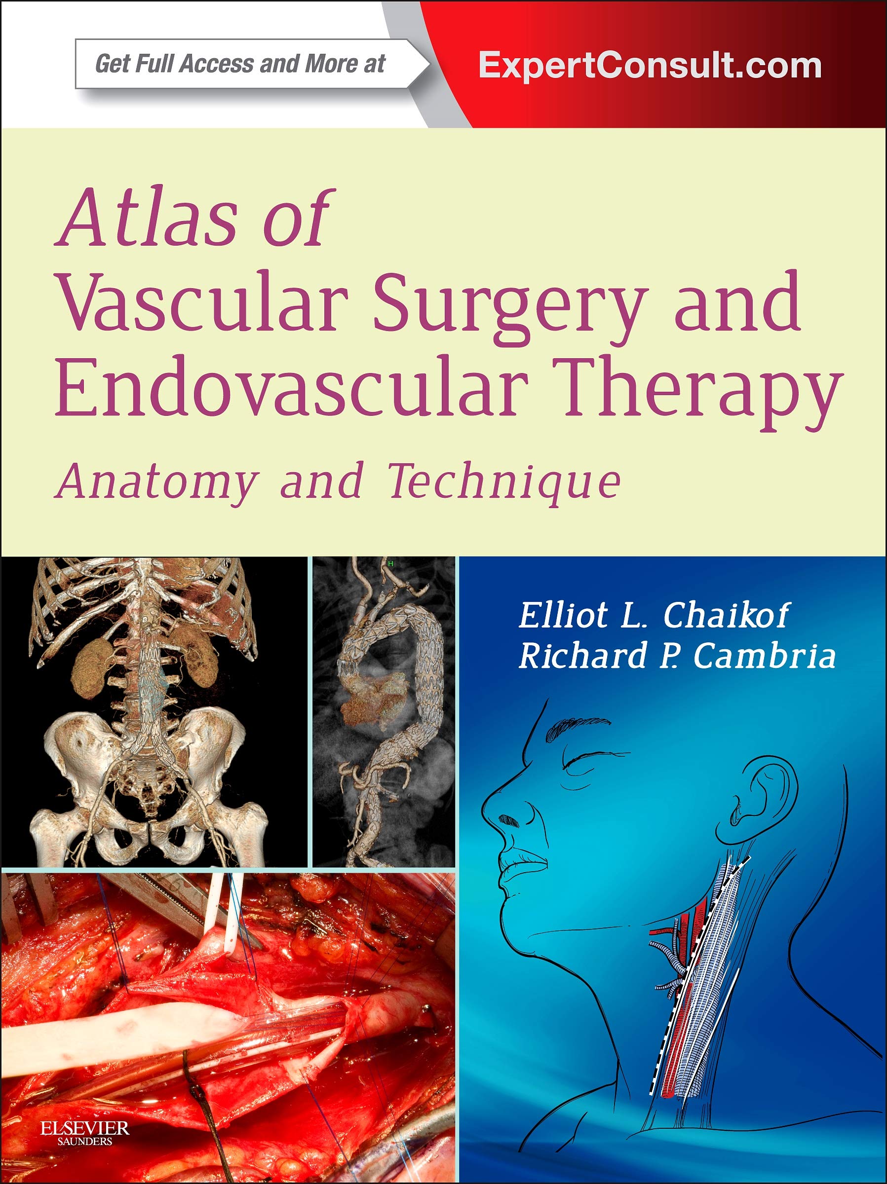 Atlas of Vascular Surgery and Endovascular Therapy,Used