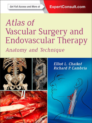 Atlas of Vascular Surgery and Endovascular Therapy,Used