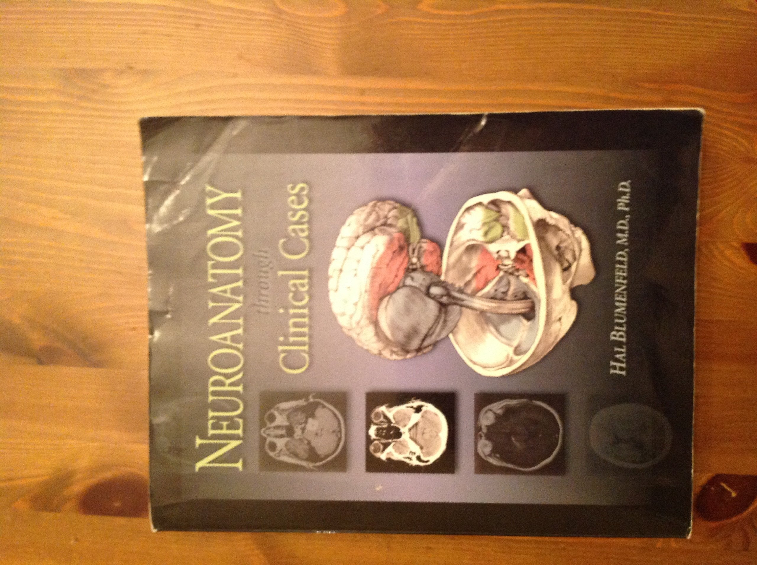 Neuroanatomy,Used