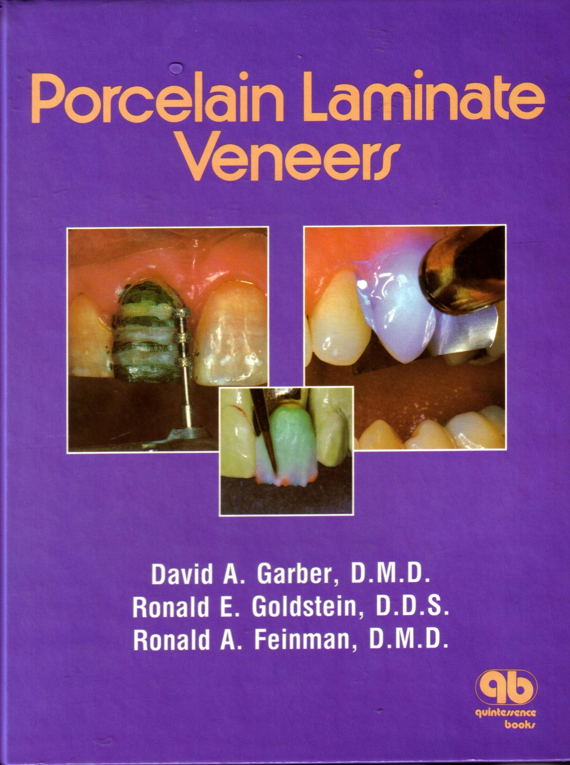Porcelain Laminate Veneers,New