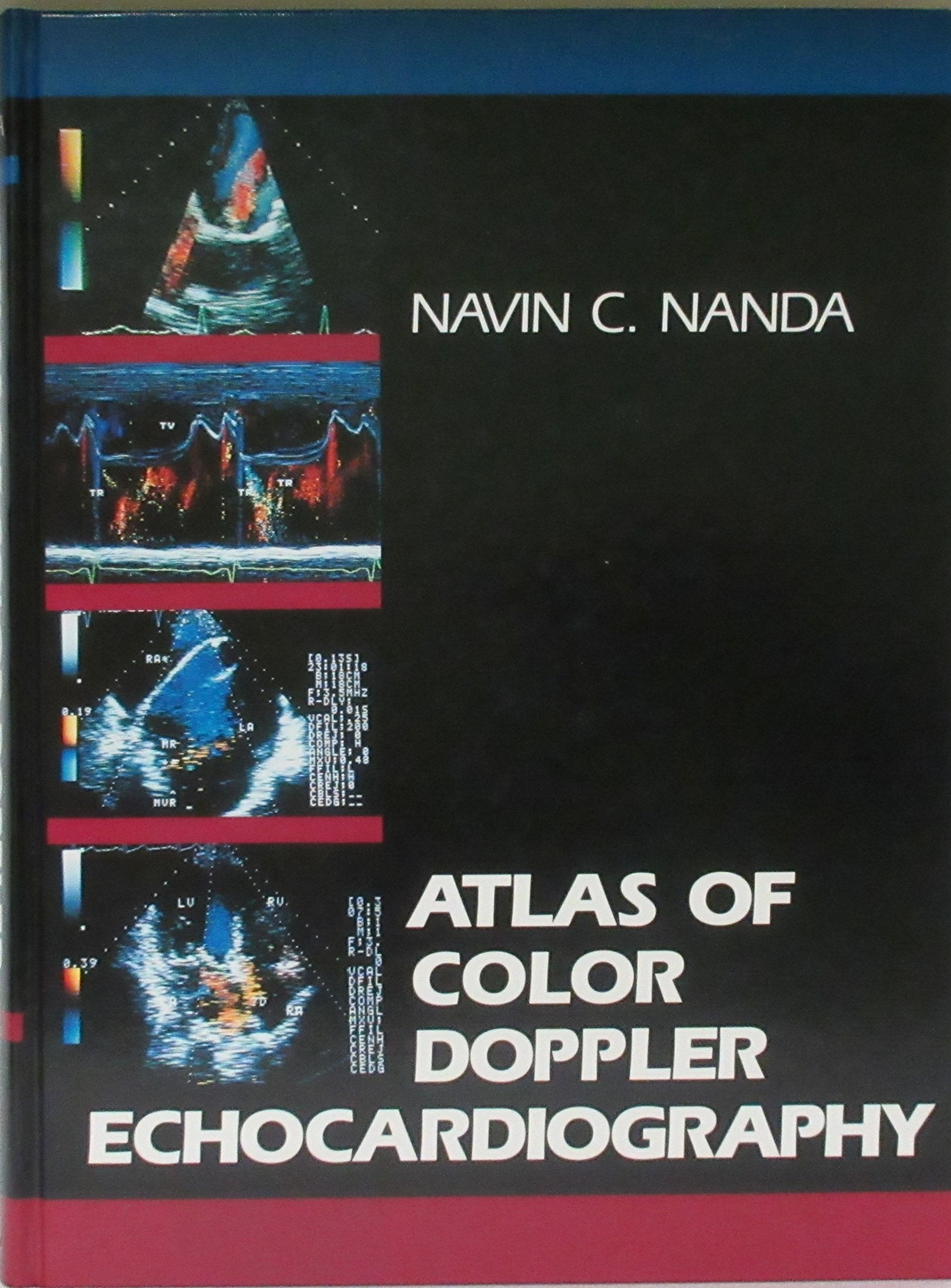 Atlas of Color Doppler Echocardiography,Used