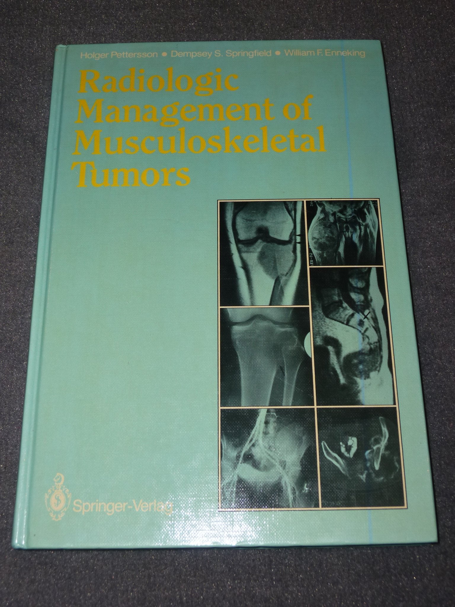 Radiologic Management of Musculoskeletal Tumors,Used