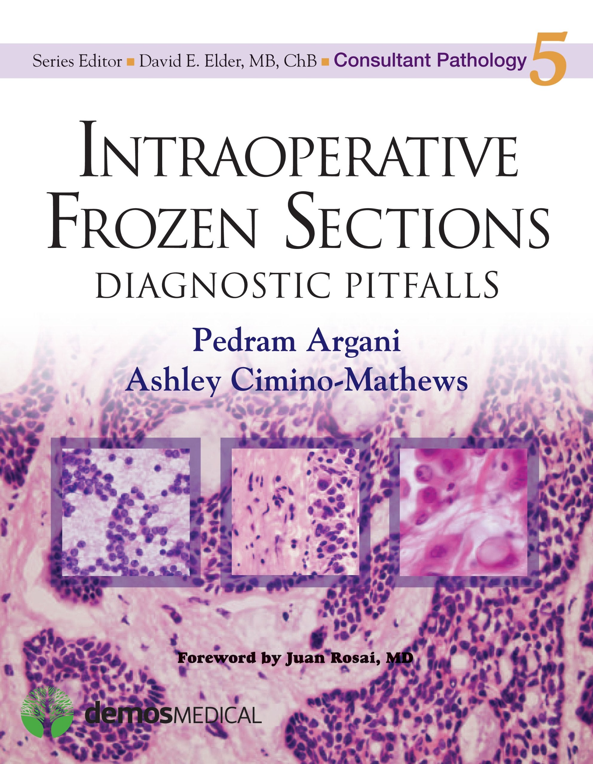 Intraoperative Frozen Sections: Diagnostic Pitfalls (Consultant Pathology, Volume 5),Used