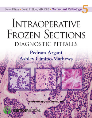 Intraoperative Frozen Sections: Diagnostic Pitfalls (Consultant Pathology, Volume 5),Used
