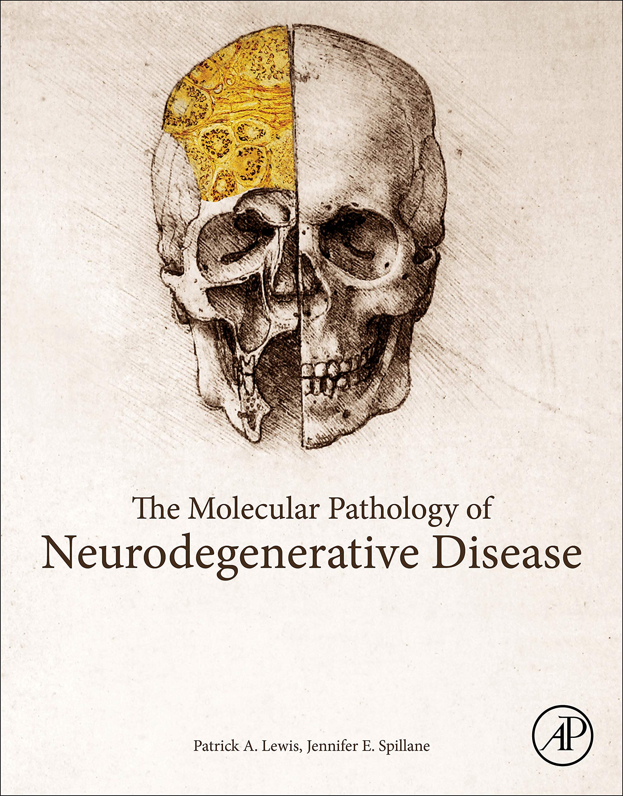 The Molecular And Clinical Pathology Of Neurodegenerative Disease,Used