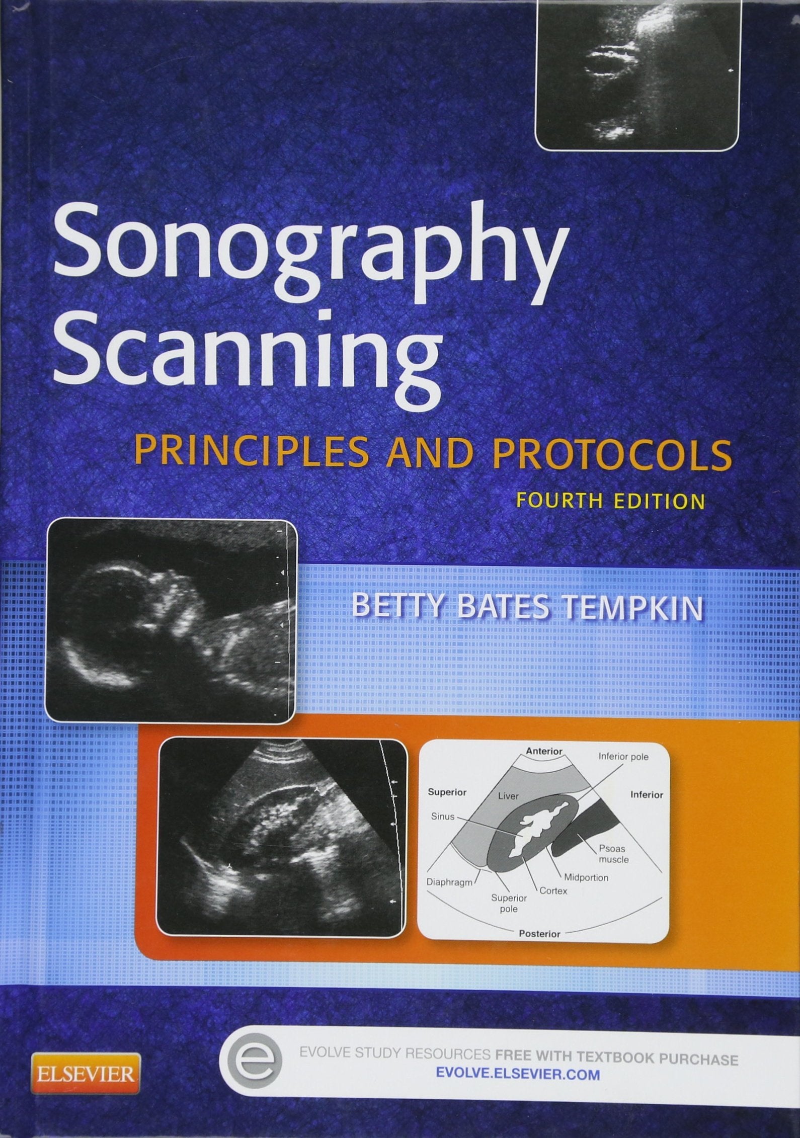 Sonography Scanning: Principles And Protocols (Ultrasound Scanning)