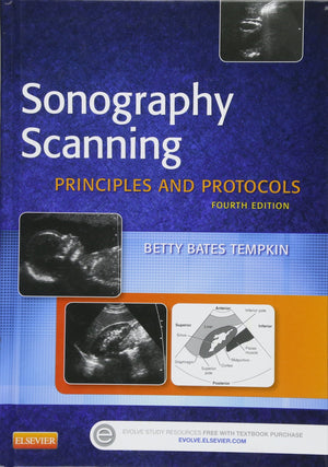 Sonography Scanning: Principles And Protocols (Ultrasound Scanning)
