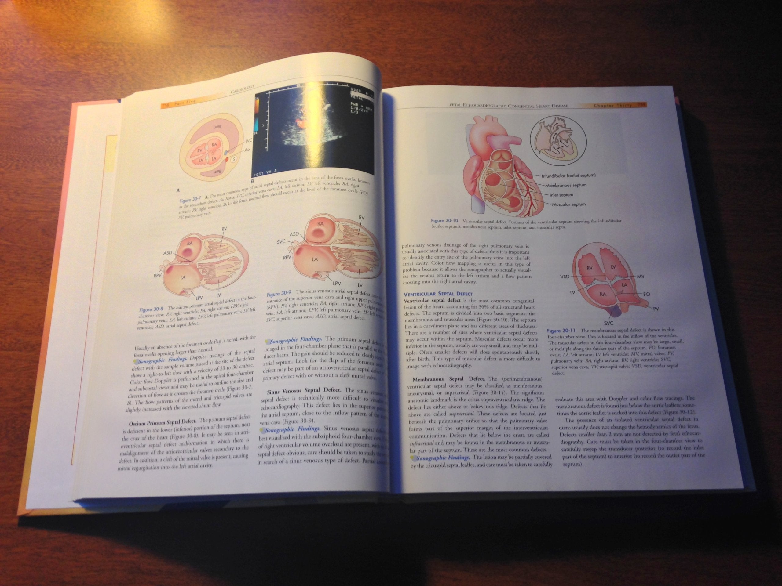 Textbook of Diagnostic Ultrasonography, Volume Two,Used