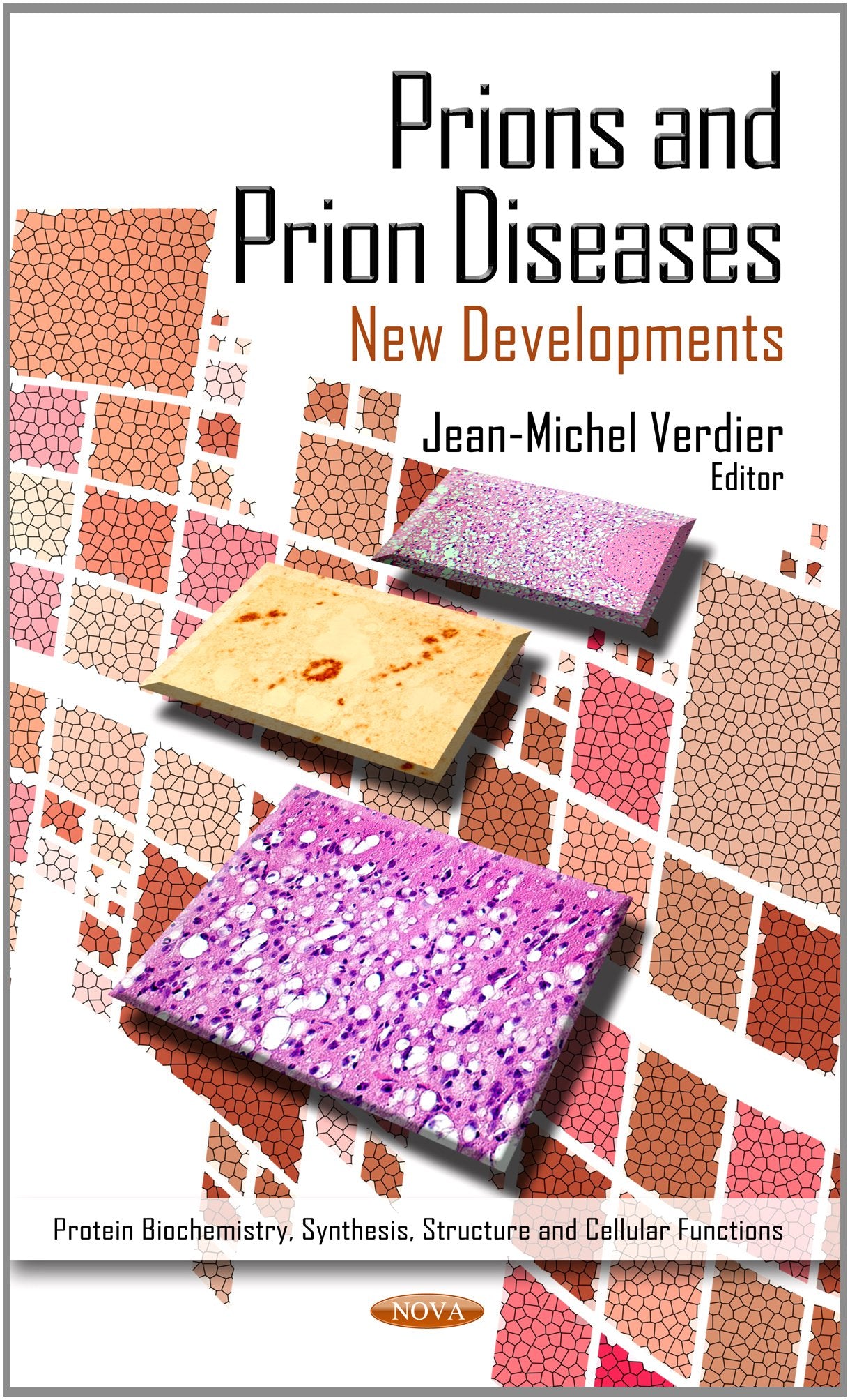 Prions And Prion Diseases: New Developments (Protein Biochemistry, Synthesis, Structure And Cellular Functions: Protein Science ,Used