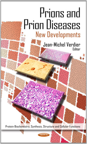 Prions And Prion Diseases: New Developments (Protein Biochemistry, Synthesis, Structure And Cellular Functions: Protein Science ,Used