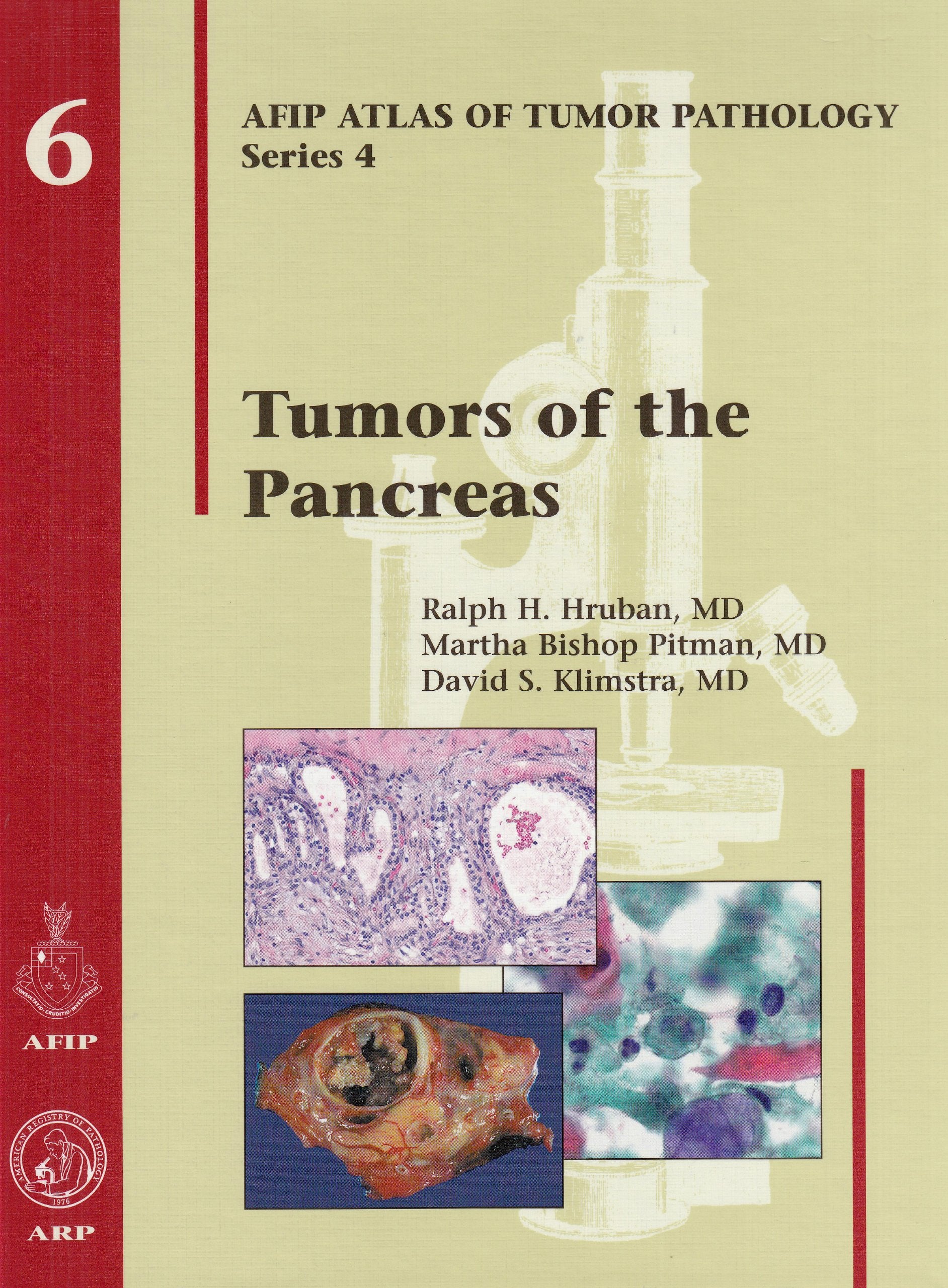 Tumors of the Pancreas (Afip Atlas of Tumor Pathology; 4th Series Fascicle 6),New
