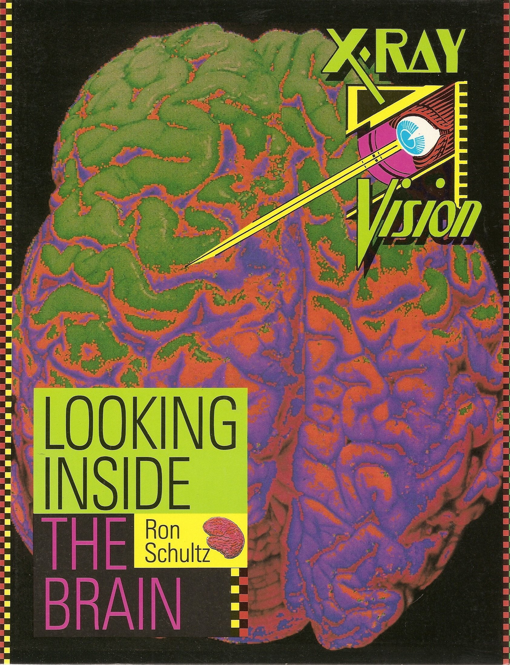 Looking Inside the Brain (XRay Vision),Used