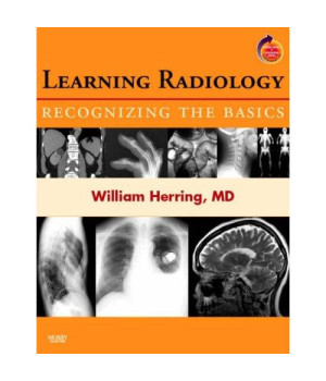 Learning Radiology: Recognizing the Basics (With STUDENT CONSULT Online Access), 1e