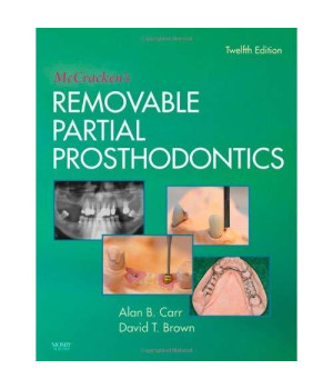 McCracken's Removable Partial Prosthodontics, 12e