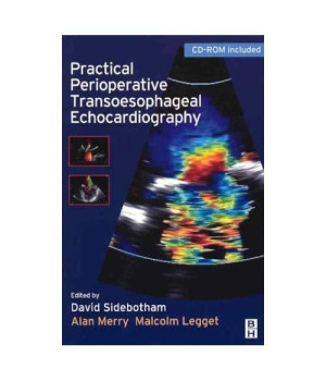 Practical Perioperative Transoesophageal Echocardiography: Text with CD-ROM, 1e