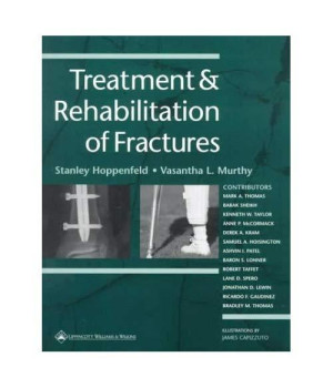 Treatment and Rehabilitation of Fractures