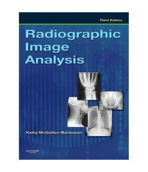 Radiographic Image Analysis, 3e