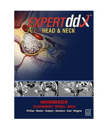 EXPERTddx: Head and Neck: Published by Amirsys® (EXPERTddx (TM))