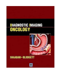 Diagnostic Imaging: Oncology: Published by Amirsys®