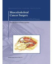 Musculoskeletal Cancer Surgery: Treatment of Sarcomas and Allied Diseases